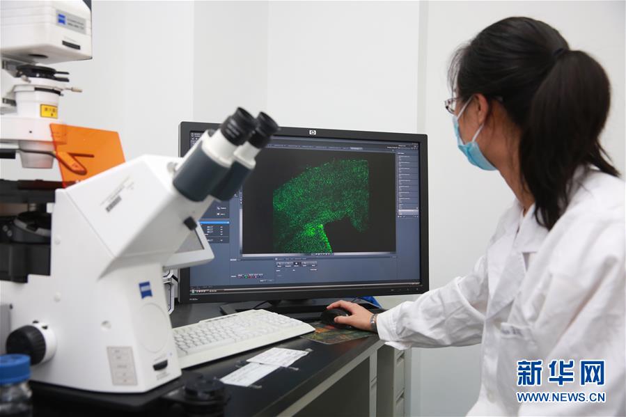 Cientistas chineses conformam liga??o entre Zika e microcefalia