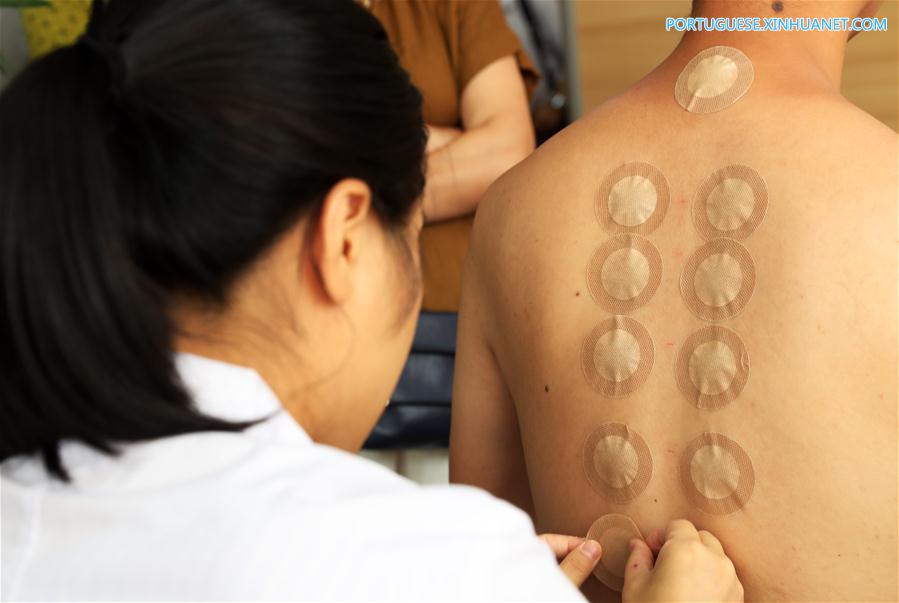 Médicos praticam tratamento de sanfutie para cidad?os na China